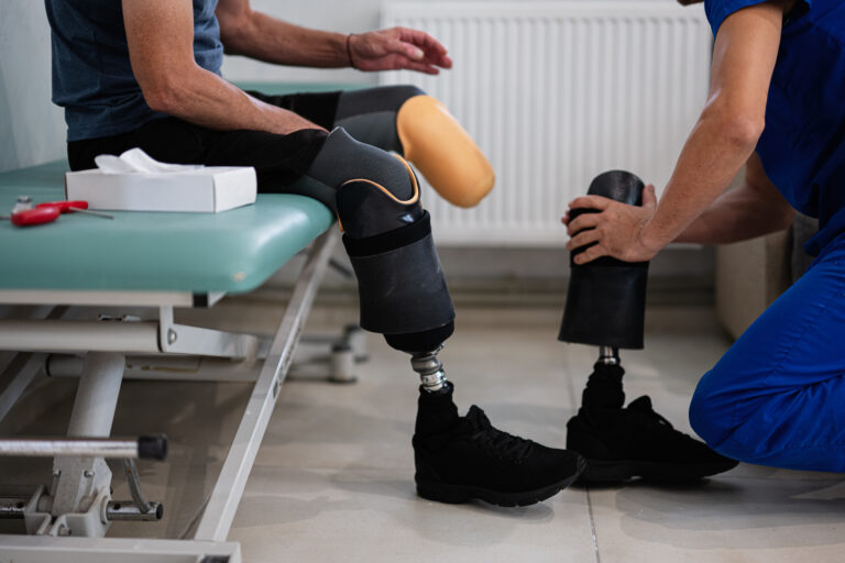 A physical therapist assists a person with a prosthetic leg during a fitting session in a rehabilitation clinic. The image captures the essence of medical care and support.